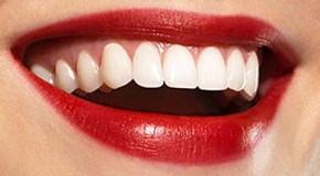 Geriausia dantų pasta jūsų dantims